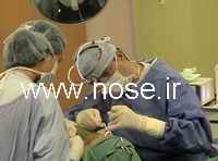 nose plastic surgery